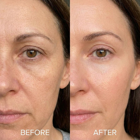 🔥Last 4 hours 49% OFF- ✨NAD+ EGF Firming Serumfor Wrinkles, Elasticity &Glow
