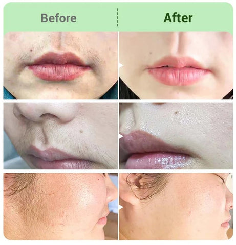 SHIFENMEI™ Hair Removal Cream for All Women & Men