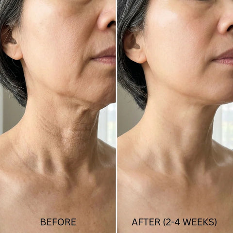 🔥Last 4 hours 49% OFF- ✨NAD+ EGF Firming Serumfor Wrinkles, Elasticity &Glow
